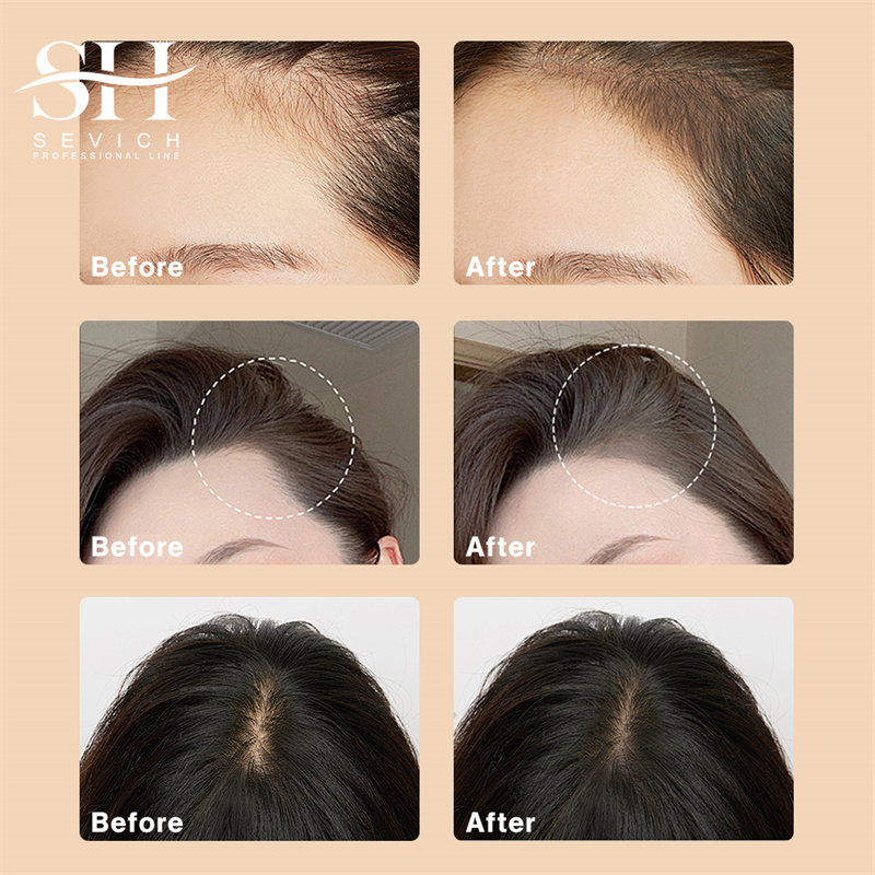 헤어 라인 섀도우 파우더 블랙 루트 커버 업 채우기 이 - Rooting Hormone Powder 리뷰 및 가격